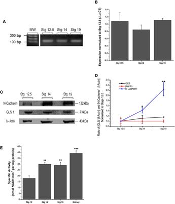 Altered Glutaminase 1 Activity During Neurulation and Its Potential Implications in Neural Tube Defects